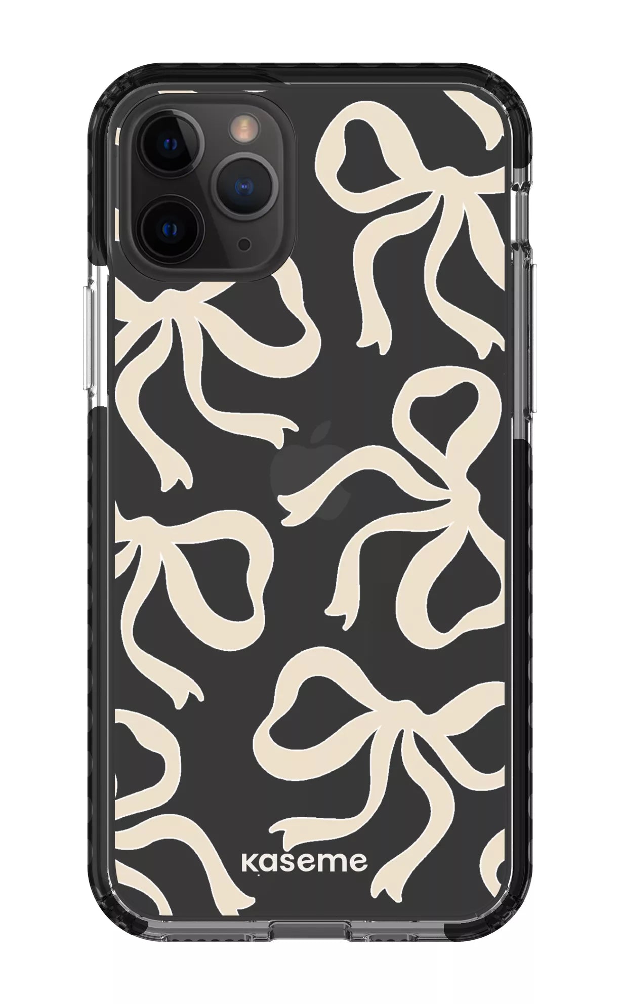 iPhone 11 Pro Clear Case - Black Lace Clear Case -